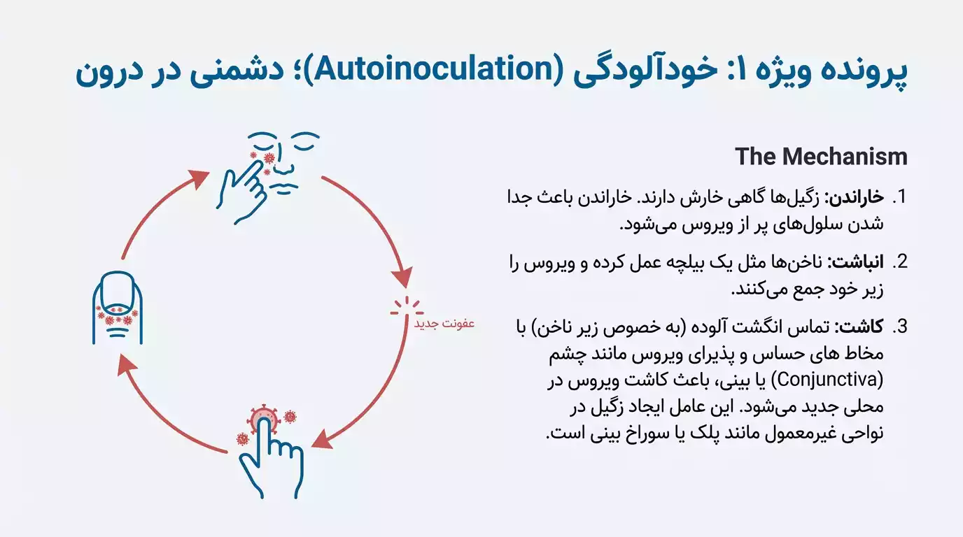 نقش خودآلودگی در انتقال زگیل تناسلی از طریق دست زدن