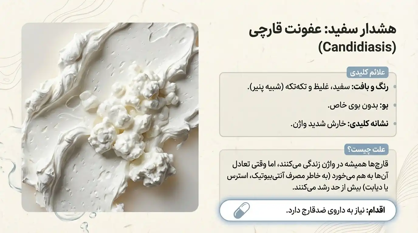 ترشحات سفید واژن ناشی از عفونت قارچی