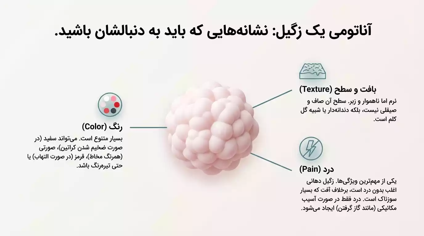 نشانه های تشخیص زگیل دهانی