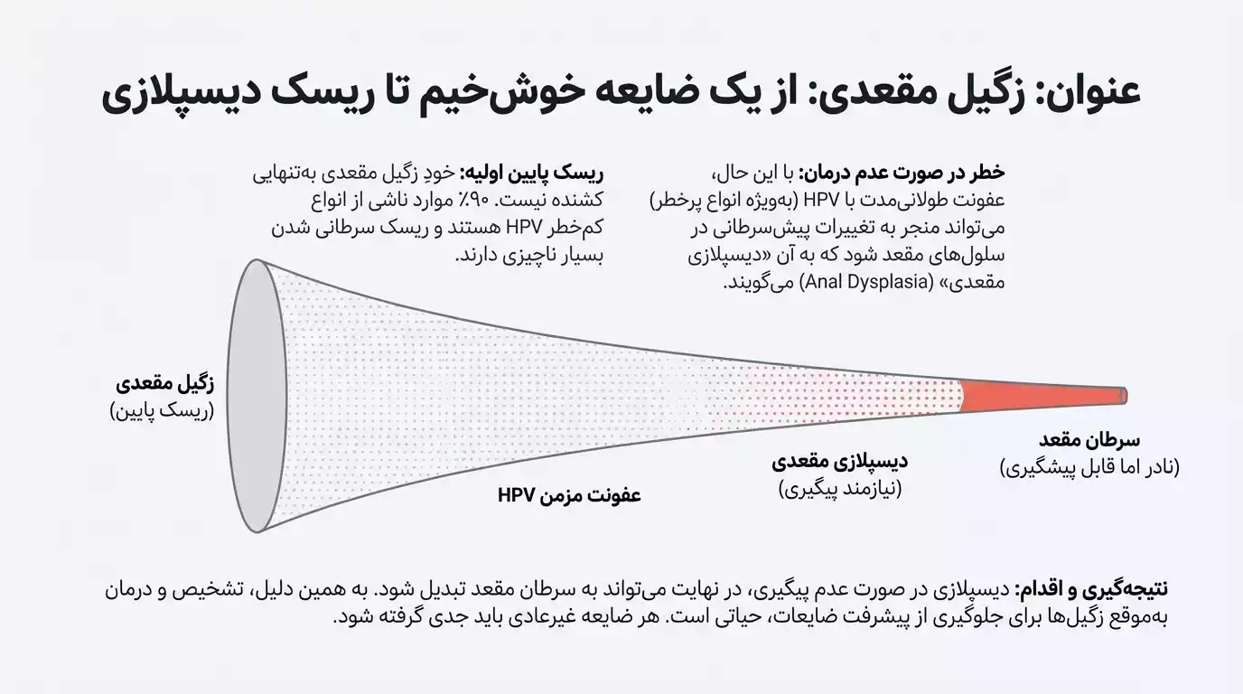 زگیل مقعدی یک ضایعه خوش خیم که در صورت عدم درمان میتواند به سرطان منتهی شود