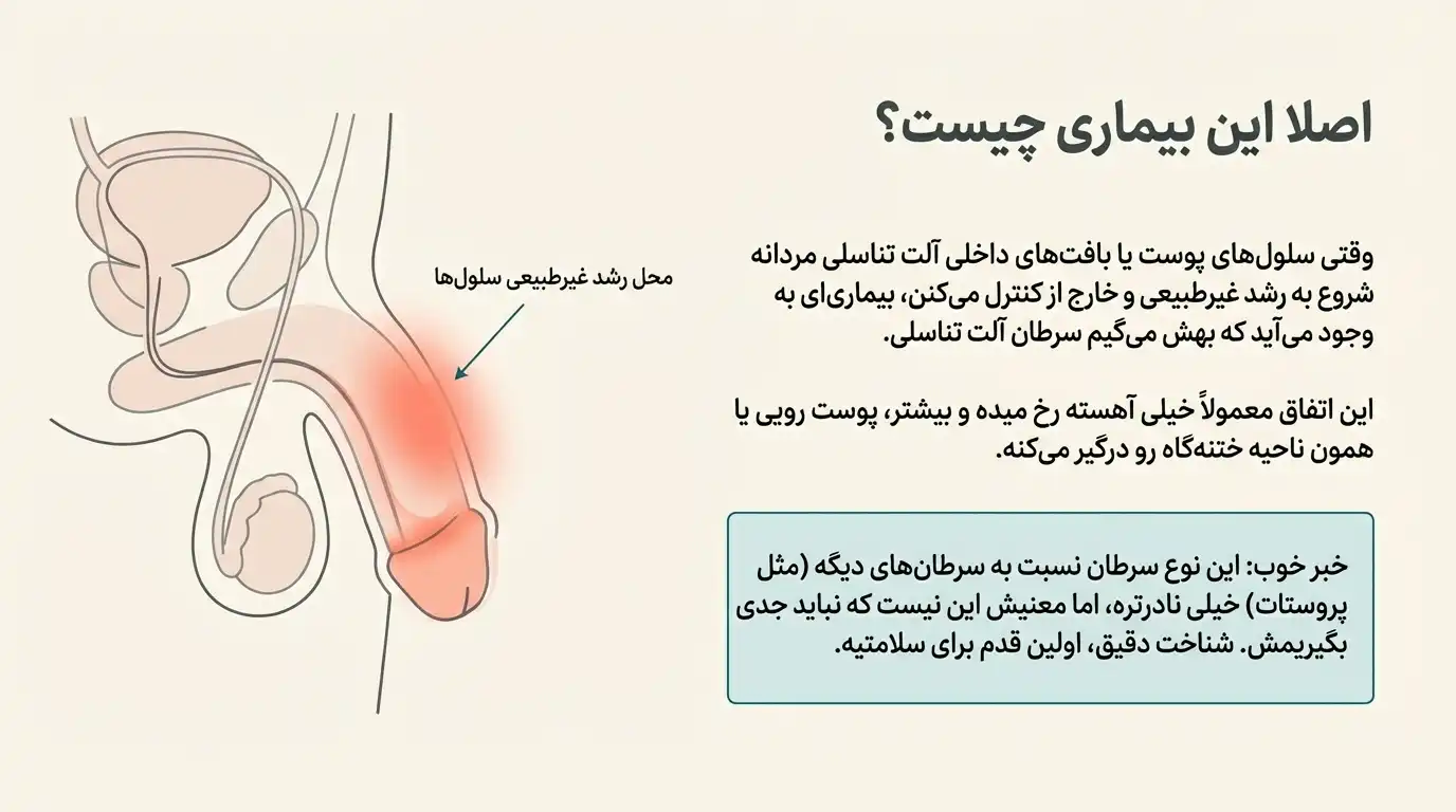نشانه های سرطان آلت تناسلی