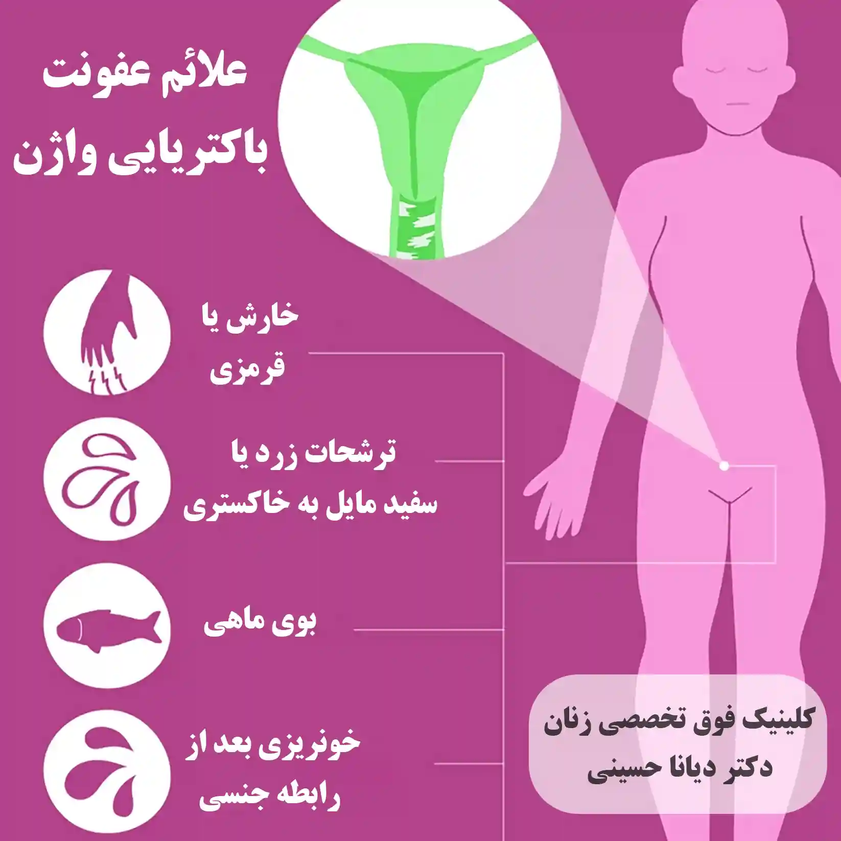 علائم غفونت واژن - دکتر دیانا حسینی بهترین دکتر عفونت واژن و رحم زنان مشهد