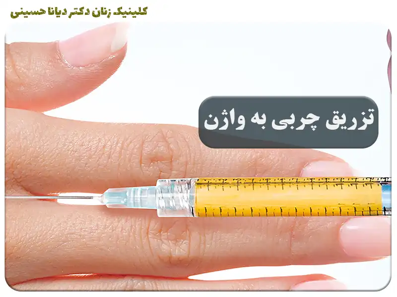 بهترین روش تزریق ژل به واژن در مشهد- دکتر دیانا حسینی