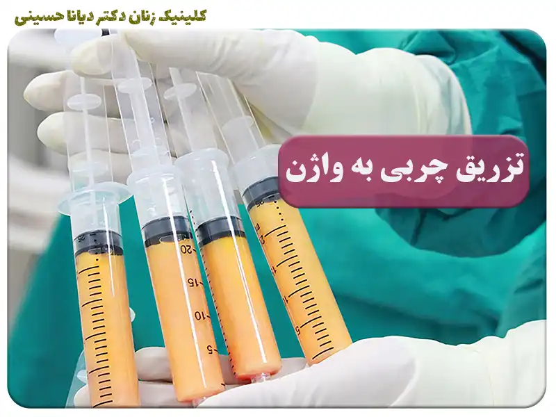 متخصص تزریق ژل به واژن در مشهد - دکتر دیانا حسینی