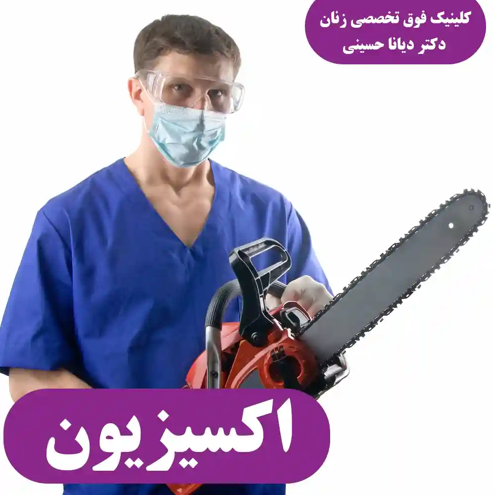 اکسیزیون
