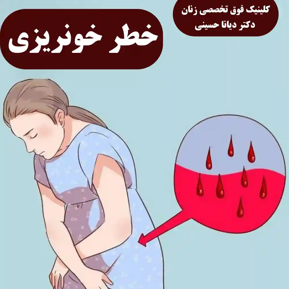 خطر خونریزی