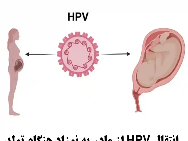 انتقال HPV از مادر به نوزاد در بدو تولد