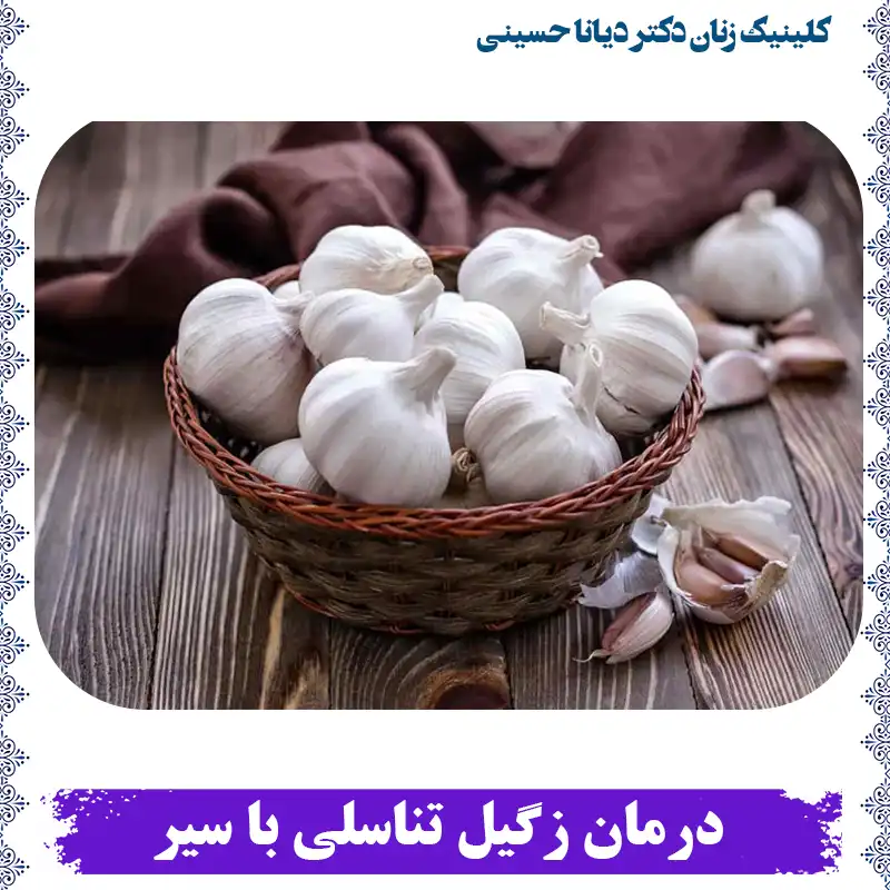 درمان زگیل تناسلی با سیر، به همراه جدول توضیحات کامل