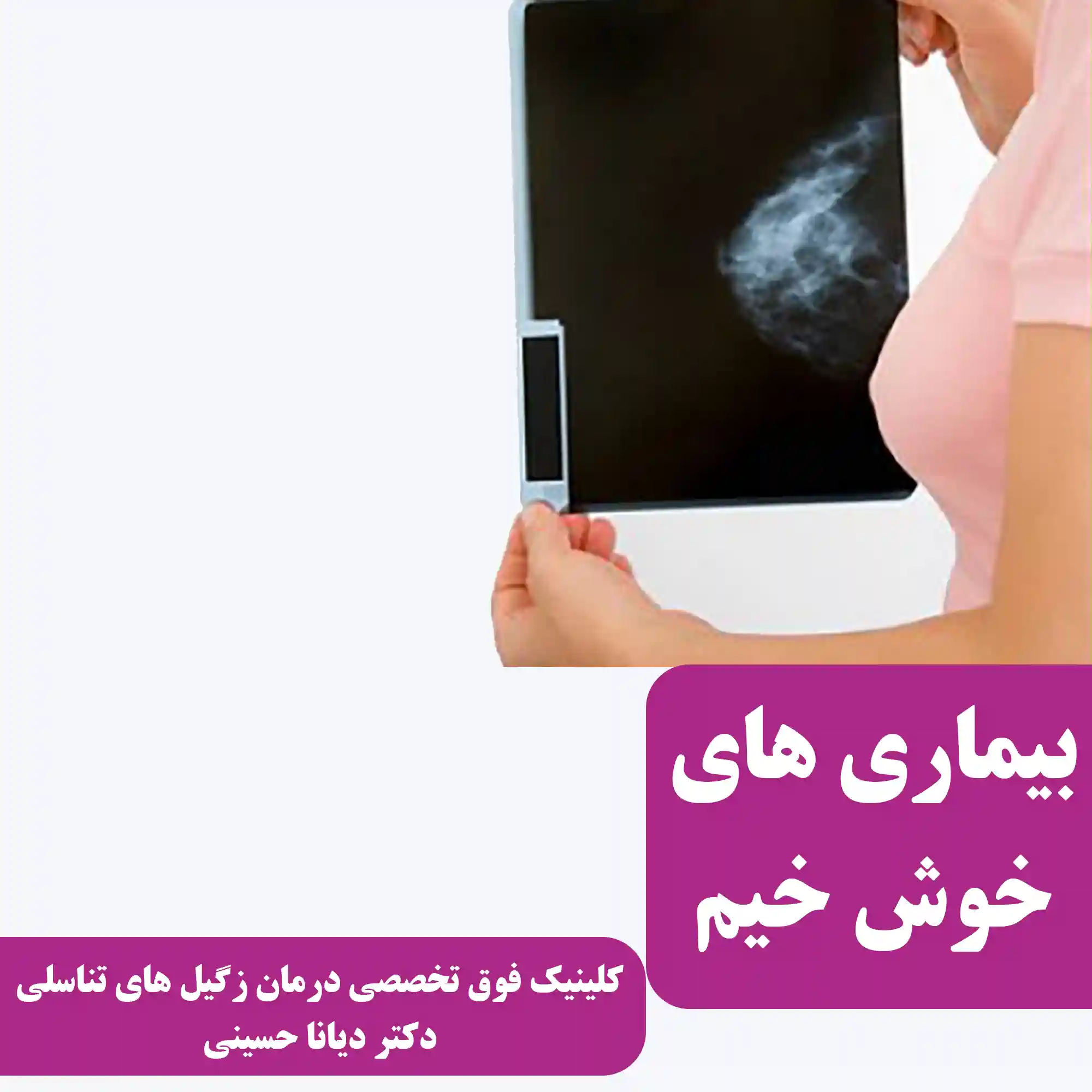 بیماری های خوش خیم