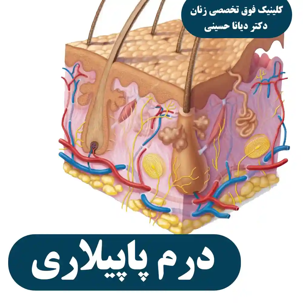 درم پاپیلاری