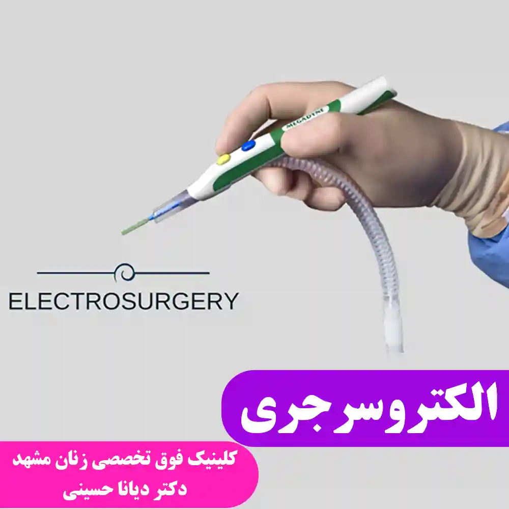 الکتروسرجری
