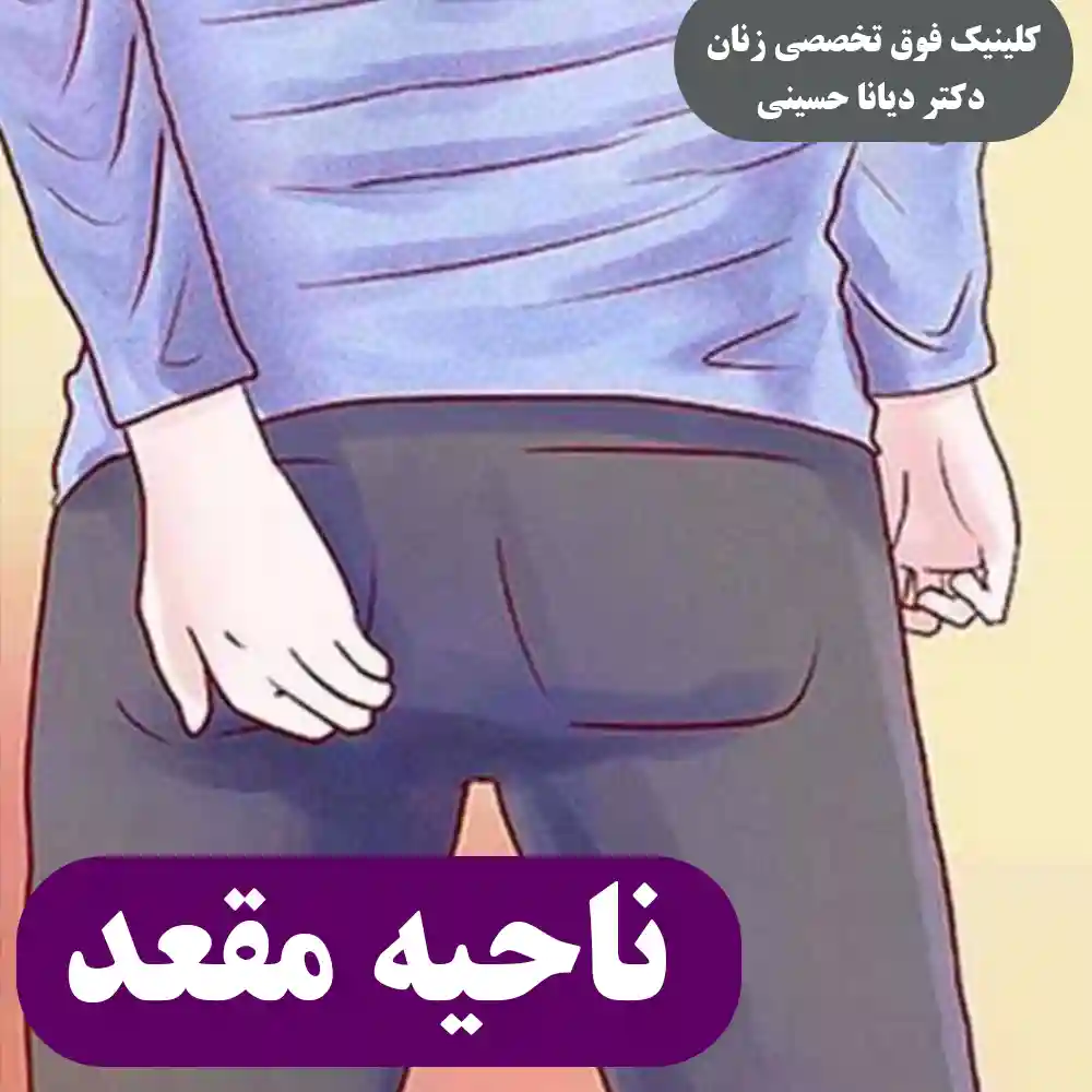 ناحیه مقعد