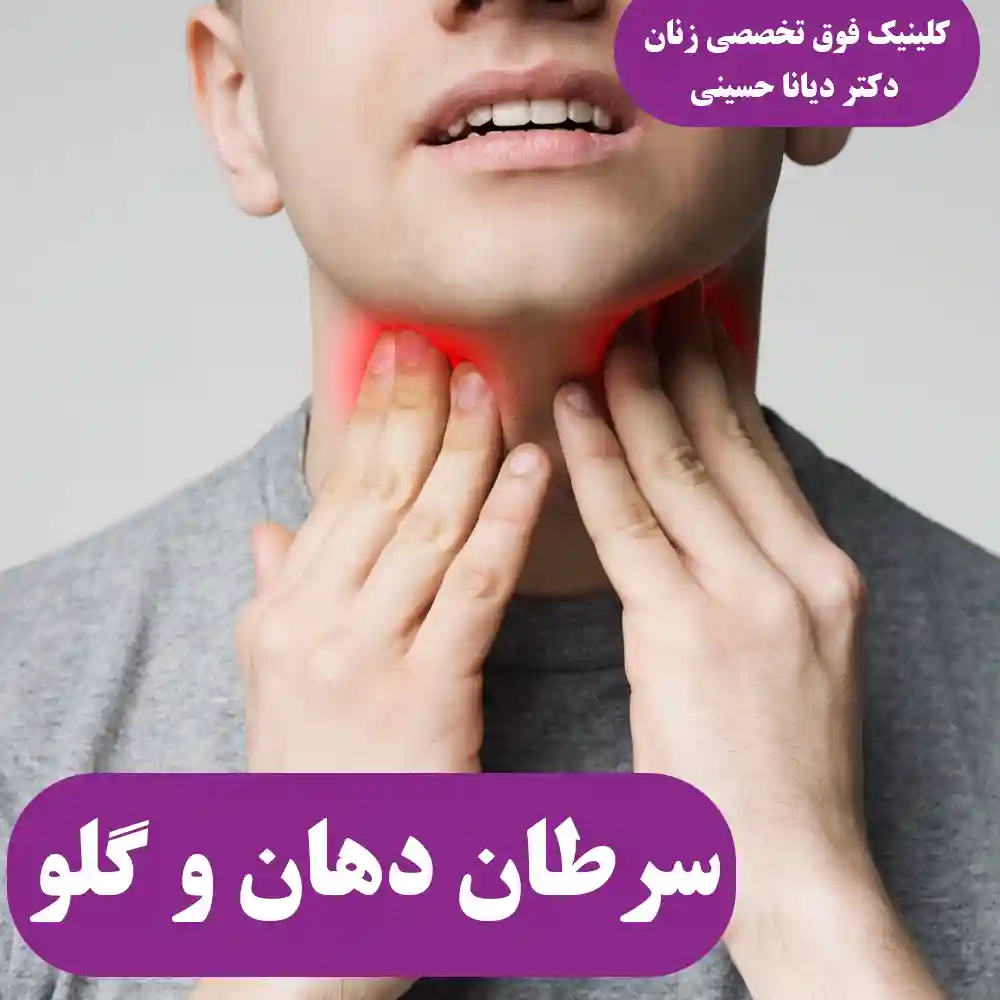 سرطان دهان و گلو