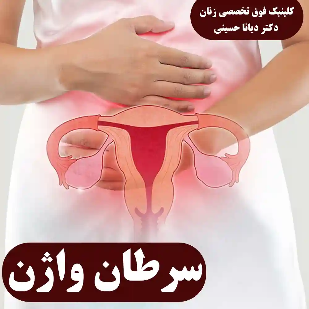 علائم سرطان واژن و درمان های آن