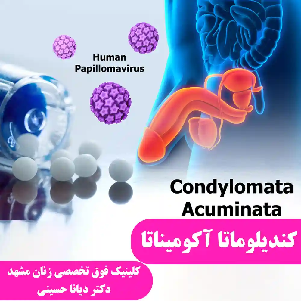 Condylomata acuminata