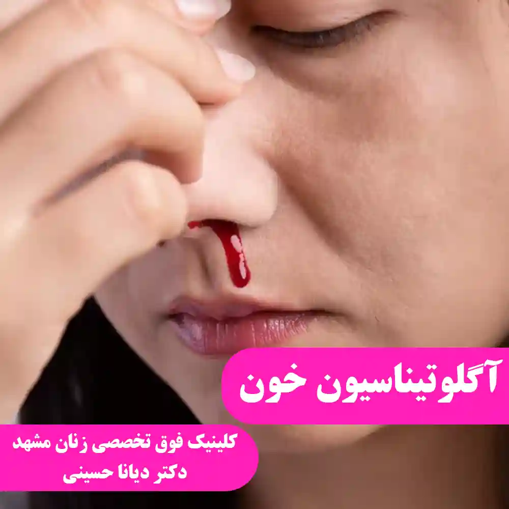 آگلوتیناسیون