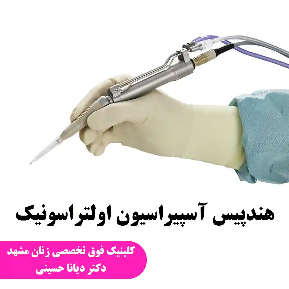 آسپیراسیون اولتراسونیک